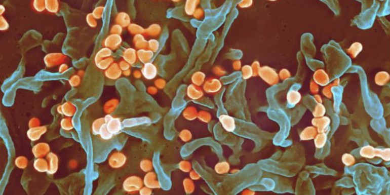 Lassa fever.jpg