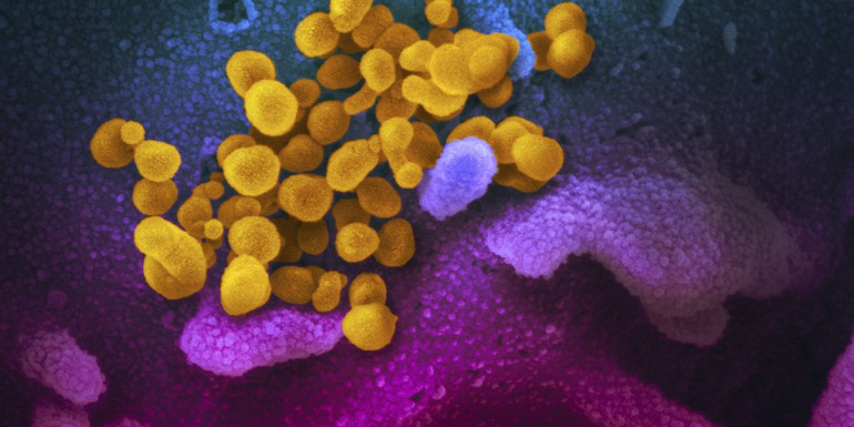 Novel Coronavirus SARS-CoV-2 - credit to National Institute of Allergy and Infectious Diseases-Rocky Mountai.jpg